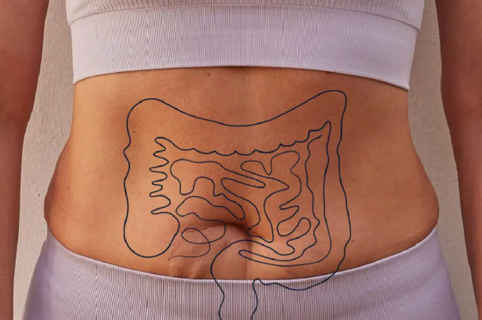 Der Darm als Zentrum der Gesundheit 11 Gezeichneter Darm auf einem Frauen Körper